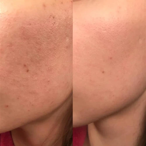 Iselie skincare review photo