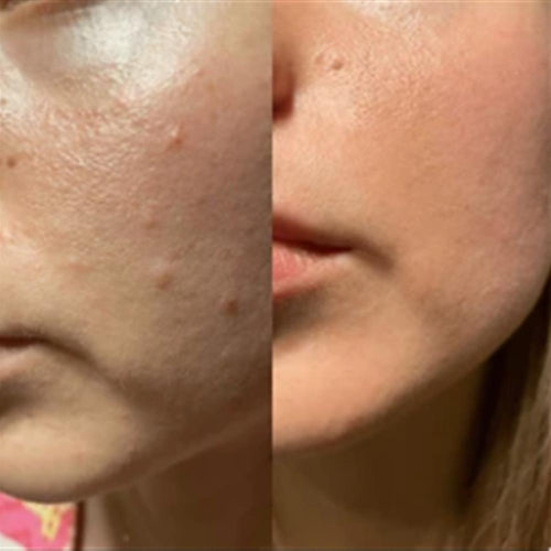 Iselie skincare review photo