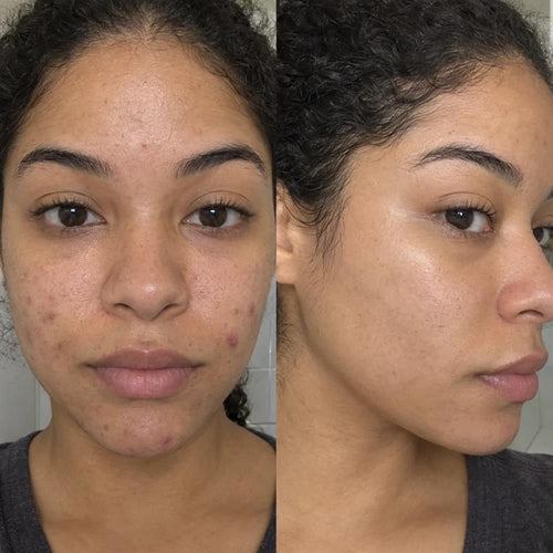 Iselie skincare review photo