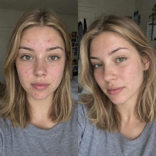 Iselie skincare review photo