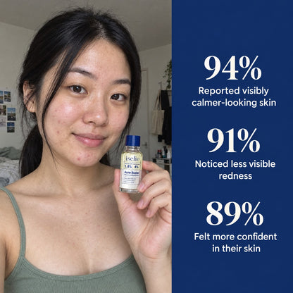 Acne Buster Drying Lotion
